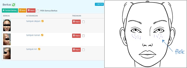 Foto profil dan sketsa wajah pasien